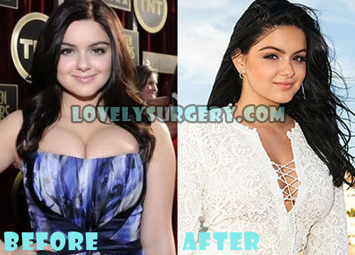 Ariel Winter Plastic Surgery Boob Job