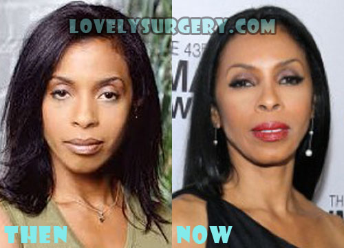 Khandi Alexander Plastic Surgery Before and After Photo