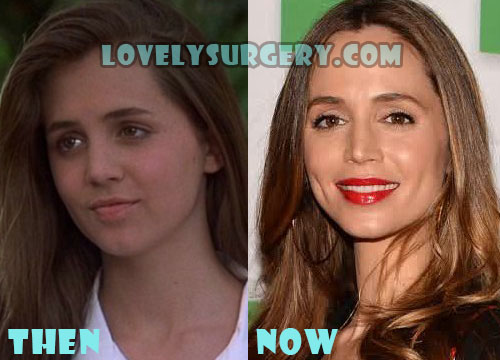Eliza Dushku Plastic Surgery Before and After Photos