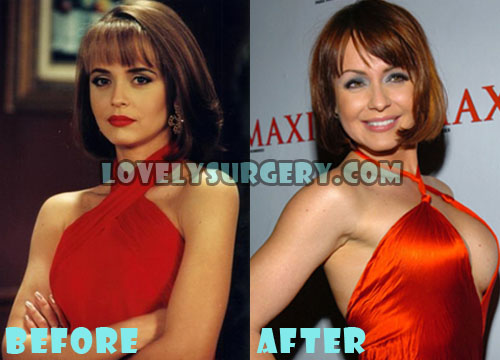 Gabriela Spanic Plastic Surgery Before and After Photos