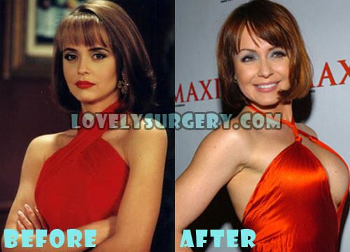 Gabriela Spanic Plastic Surgery Breast Implant