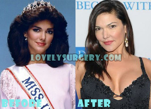 Laura Harring Plastic Surgery Before and After Boob Job
