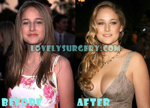 Leelee Sobieski Plastic Surgery Boob Job