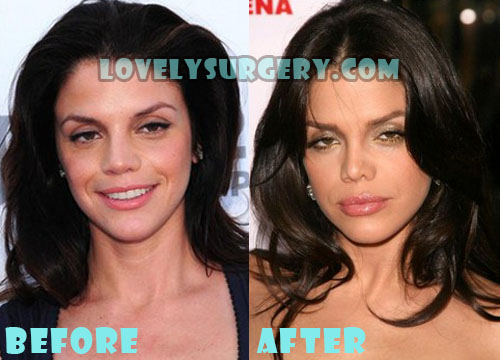 Vanessa Ferlito Plastic Surgery Before and After Photo