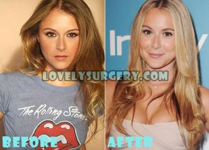 Alexa Vega Plastic Surgery Boob Job