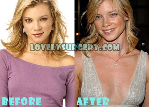 Amy Smart Plastic Surgery Boob Job