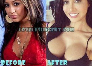 Joselyn Cano Plastic Surgery Boob Job