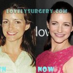 Kristin Davis Plastic Surgery Botox