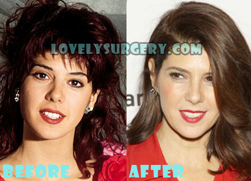 Marisa Tomei Plastic Surgery Nose Job