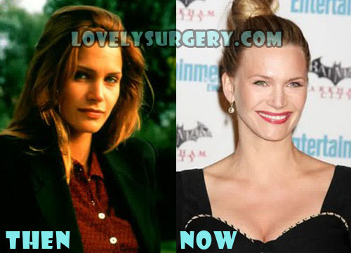 Natasha Henstridge Plastic Surgery Before and After Photos