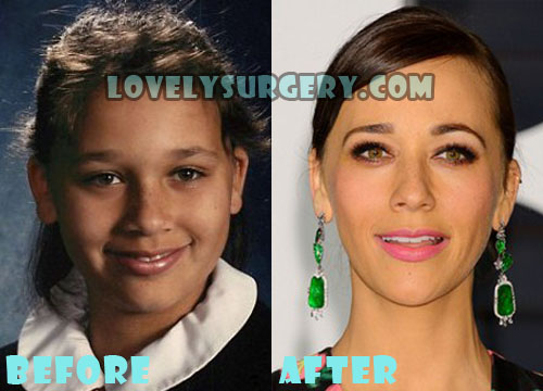 Rashida Jones Plastic Surgery Before and After Nose Job