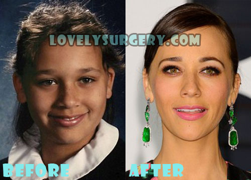 Rashida Jones Plastic Surgery Nose Job