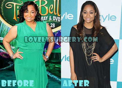 Raven Symone Plastic Surgery Liposuction