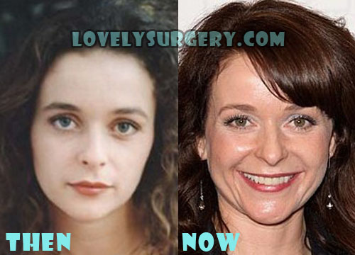 Julia Sawalha Plastic Surgery Before and After Photos