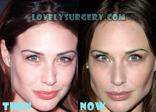 Claire Forlani Plastic Surgery Before and After Photos