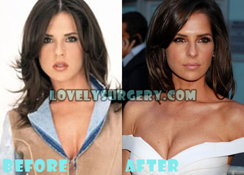 Kelly Monaco Plastic Surgery