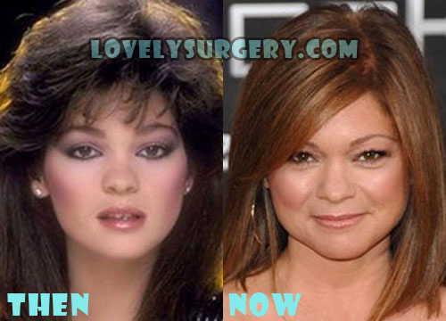 Valerie Bertinelli Plastic Surgery Before and After Rumor