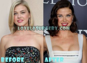 Adrianne Palicki Plastic Surgery Breast Implant