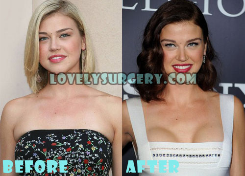Adrianne Palicki Plastic Surgery Before and After Boob Job