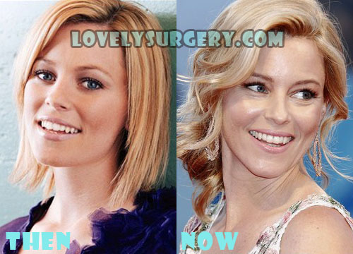 Elizabeth Banks Plastic Surgery Before and After Photos