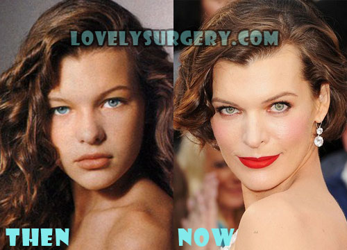Milla Jovovich Plastic Surgery Before After, Fact or Rumor?