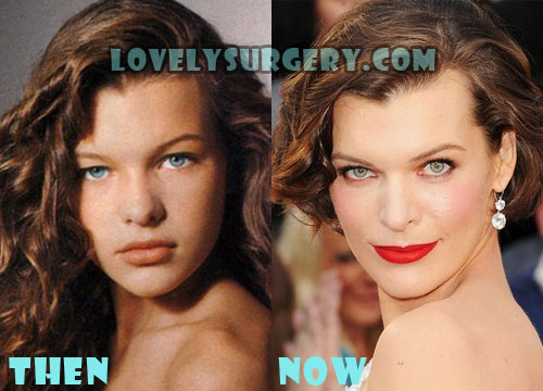 Milla Jovovich Plastic Surgery Botox - Lovely Surgery.