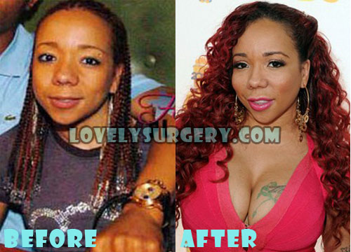 Tameka Cottle Plastic Surgery Boob Job