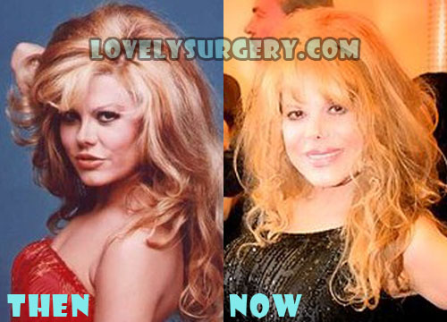 Charo Bad Plastic Surgery