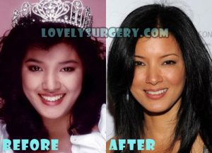 Kelly Hu Plastic Surgery Nose Job