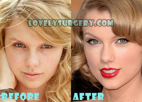 Taylor Swift Plastic Surgery Nose Job