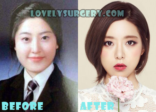 DJ Soda Plastic Surgery Before and After Rumor