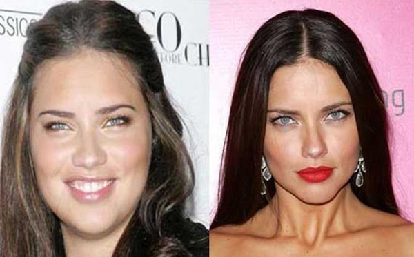 Did Adriana Lima undergo plastic surgery? 