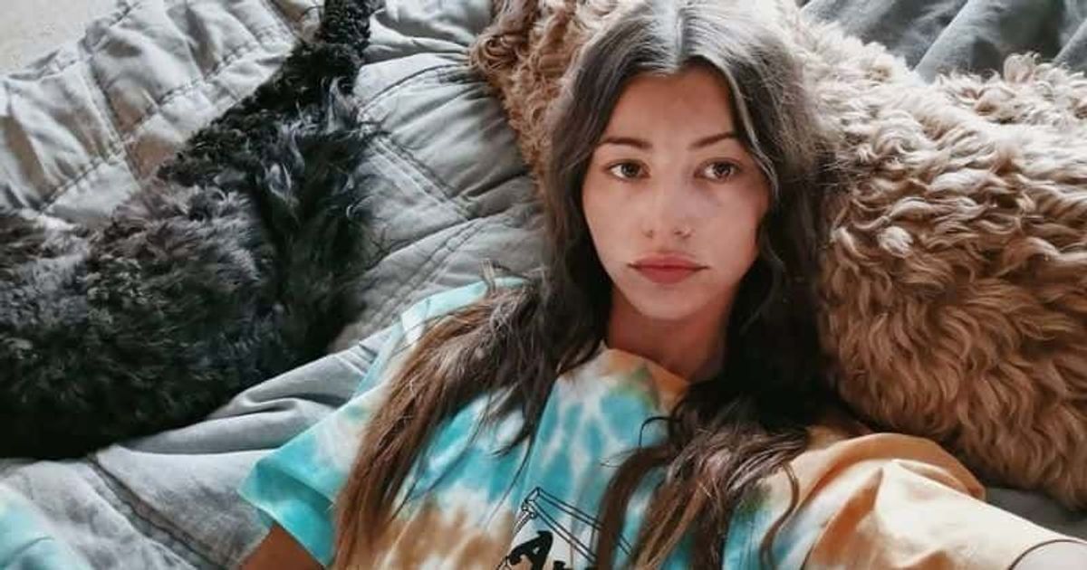What Plastic Surgery Has Eleanor Calder Done?