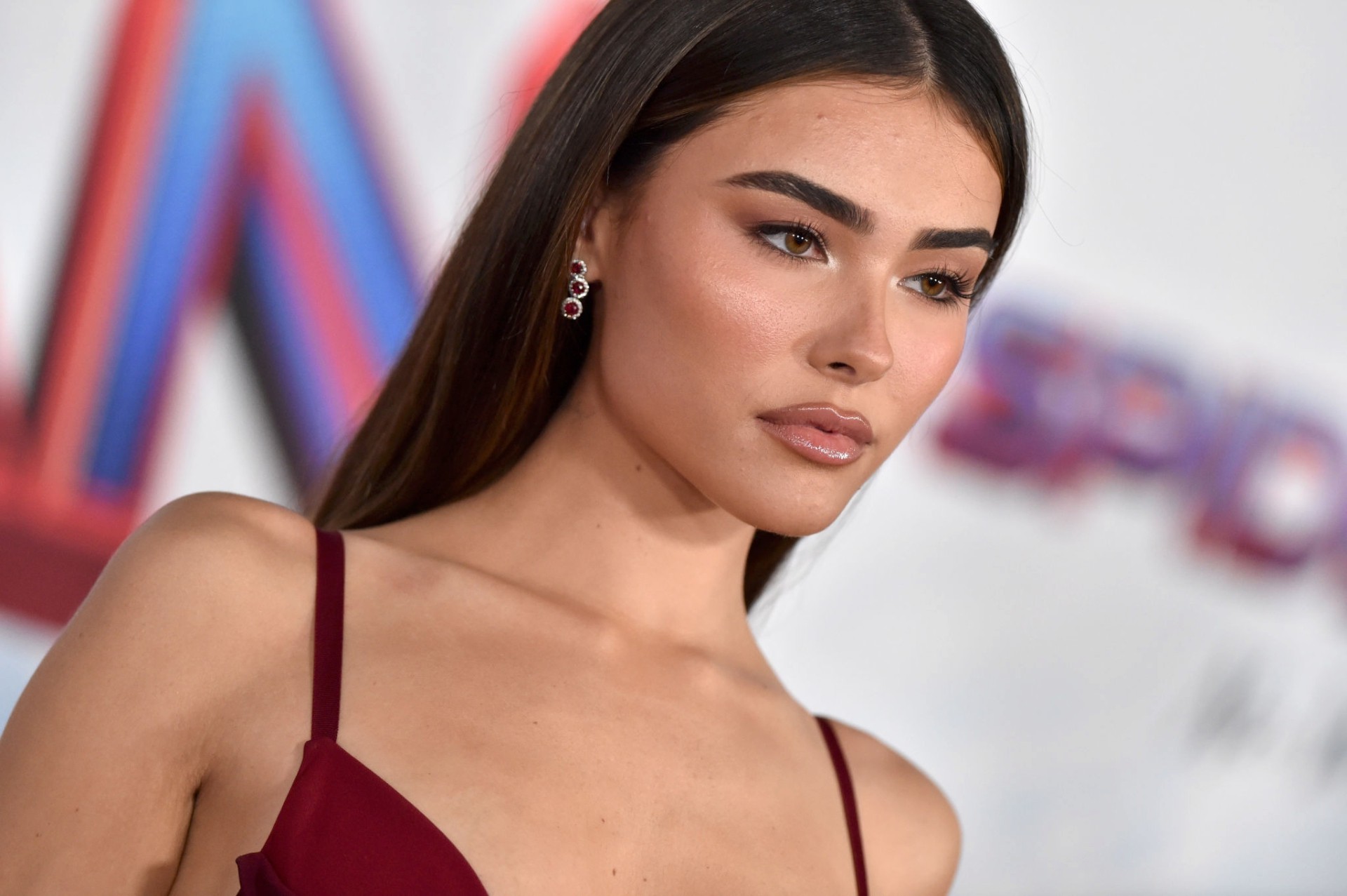 Madison Beer Plastic Surgery: Lips and Fillers