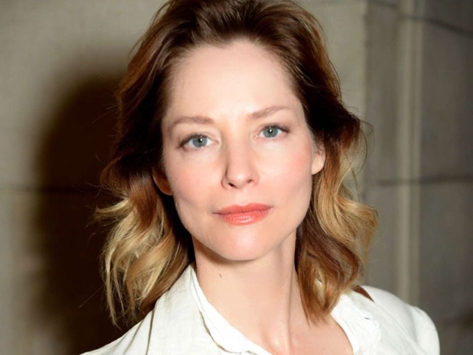 Sienna Guillory Plastic Surgery Face