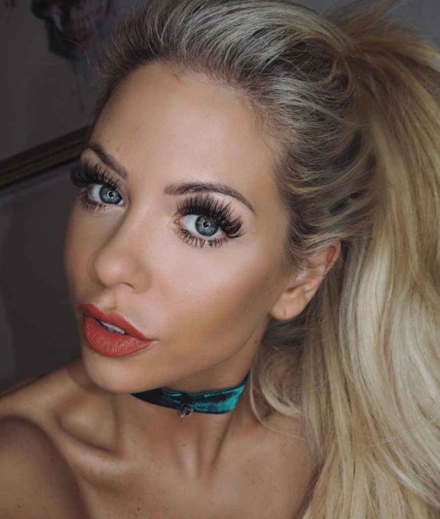 Bianca Gascoigne Cosmetic Surgery Face