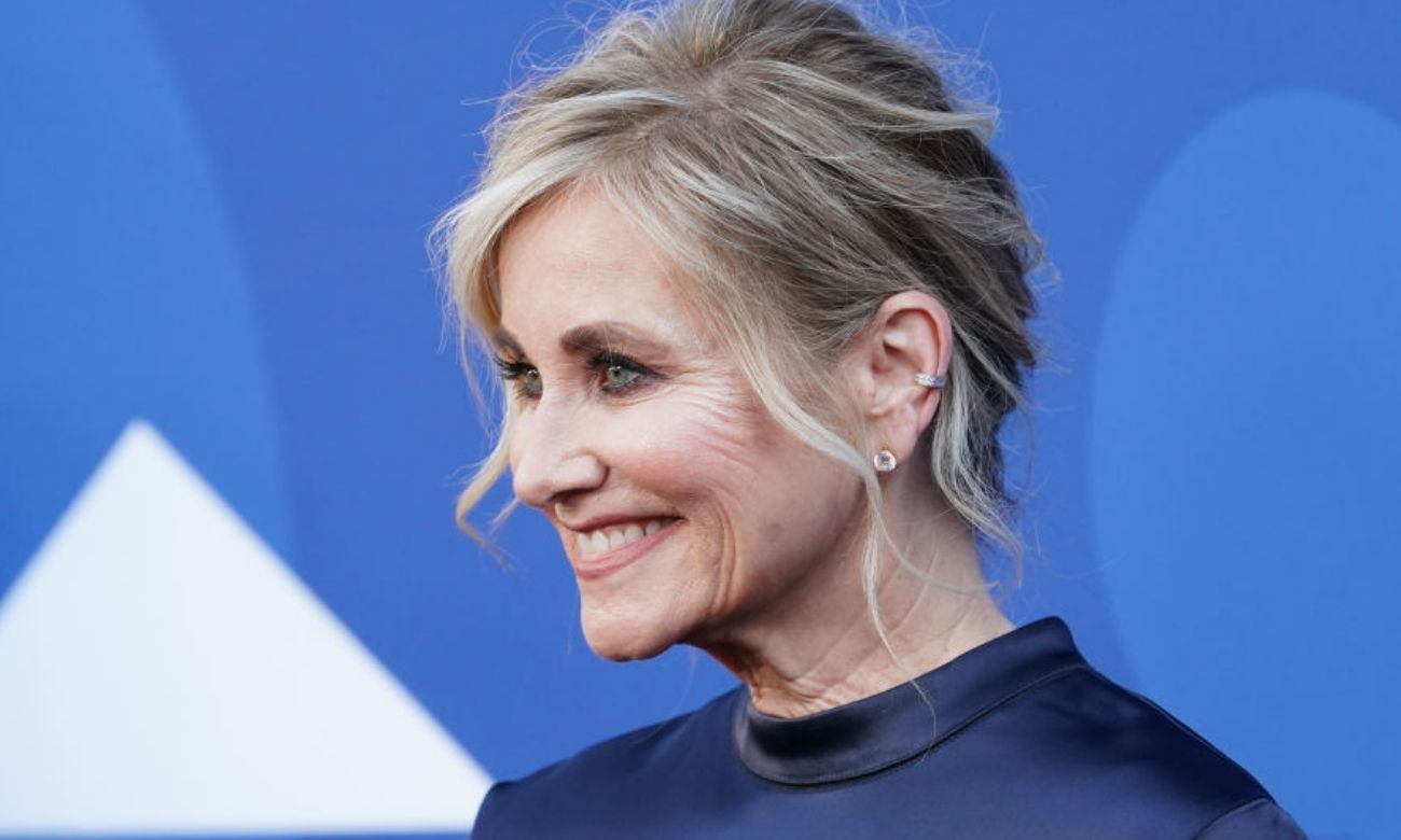 Maureen McCormick Cosmetic Surgery