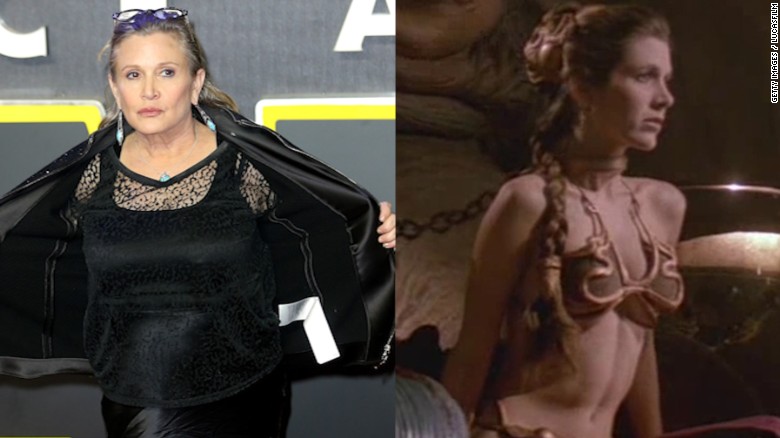 Carrie Fisher Plastic Surgery Body