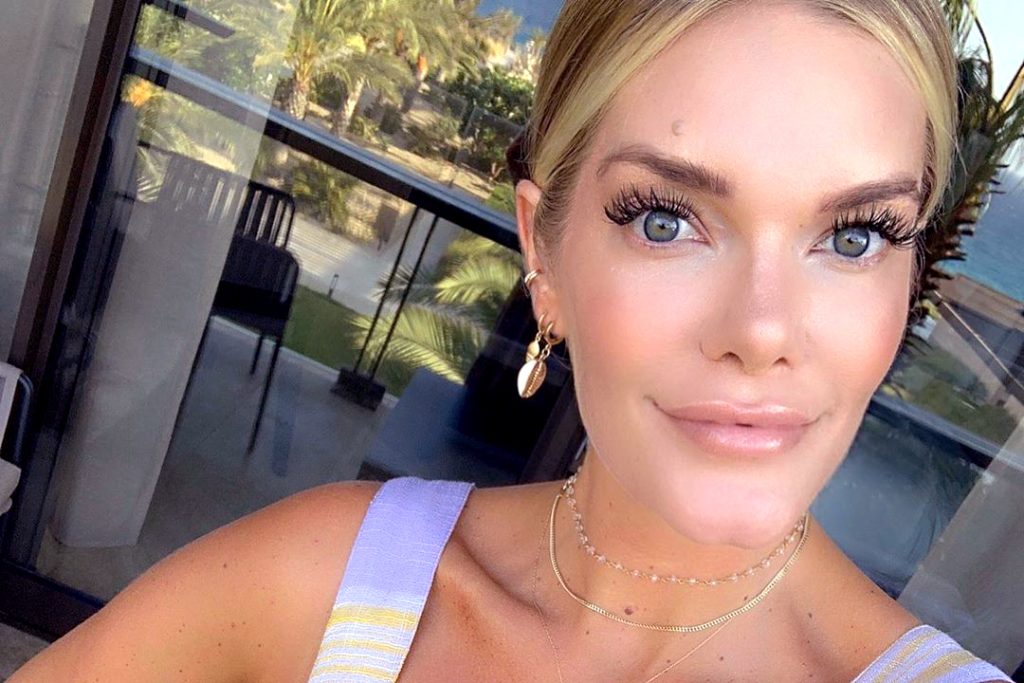 Lauren Wirkus Plastic Surgery Face