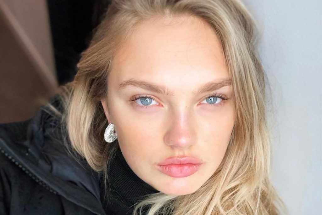 Romee Strijd Cosmetic Surgery Face