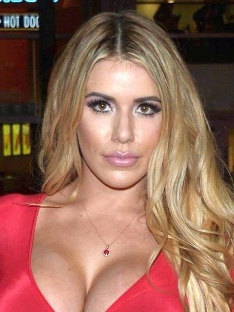 Chantel Zales Plastic Surgery Face