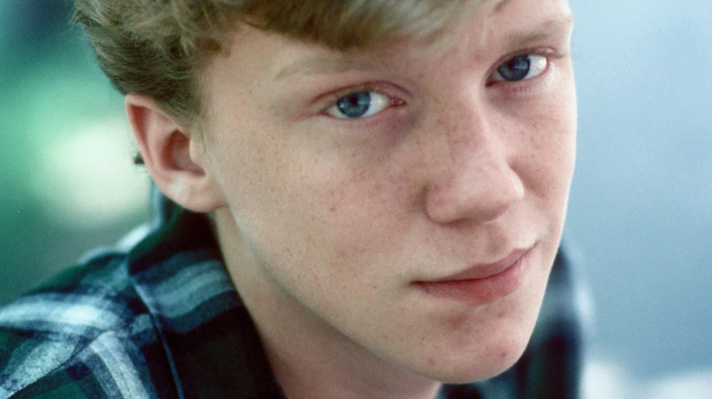 Anthony Michael Hall Cosmetic Surgery Face