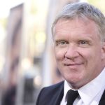 Anthony Michael Hall Plastic Surgery