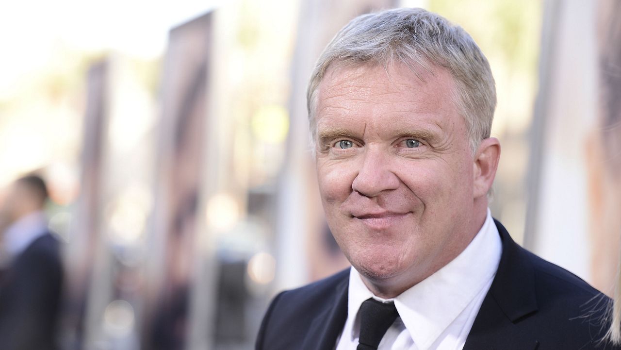 Anthony Michael Hall Plastic Surgery