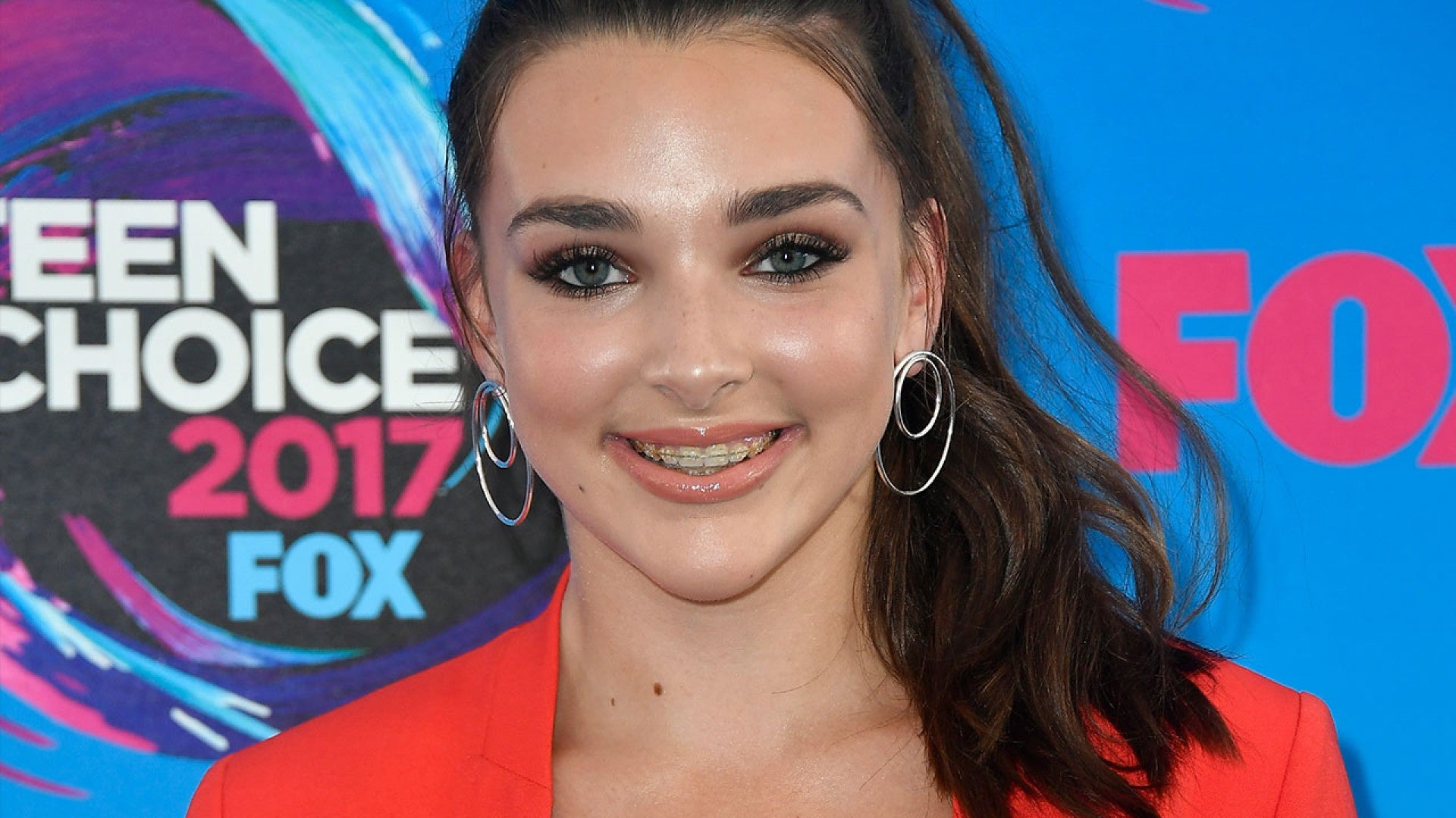 What Plastic Surgery Has Kendall Vertes Had?