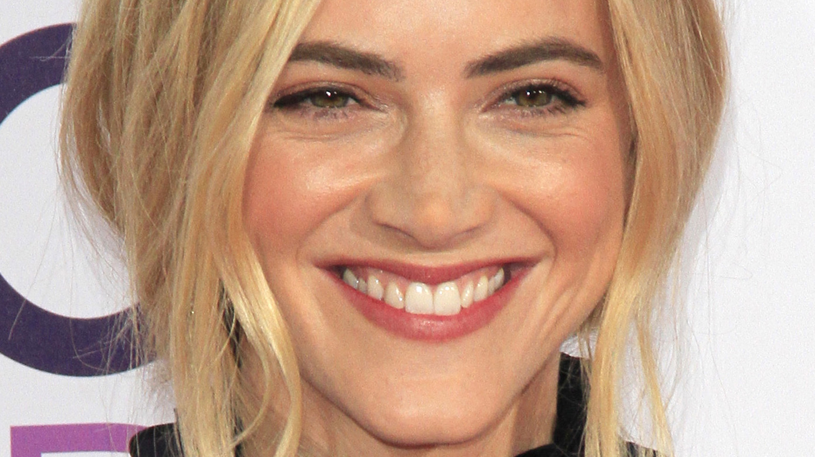 Emily Wickersham Plastic Surgery Procedures