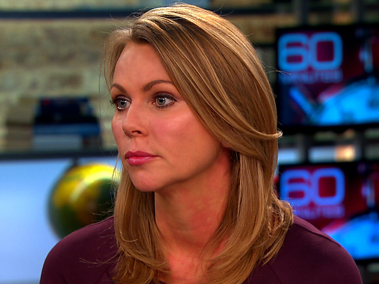 Lara Logan Cosmetic Surgery