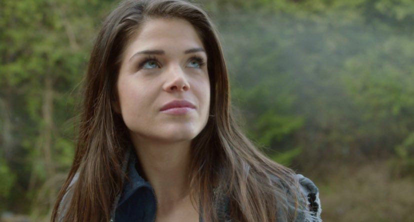 Did Marie Avgeropoulos Get Plastic Surgery?