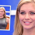 Rachel Riley Plastic Surgery Procedures