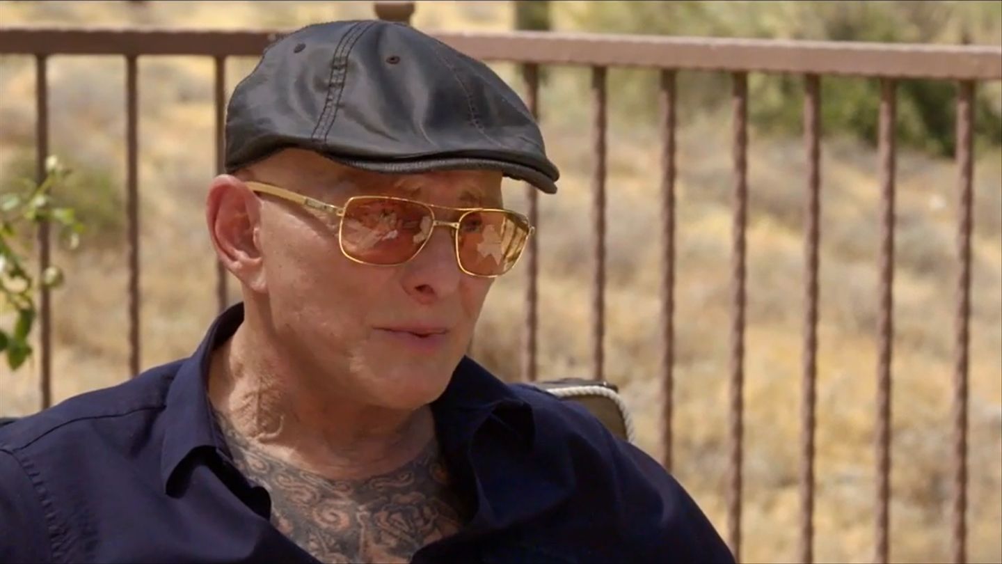 Sammy Gravano Cosmetic Surgery